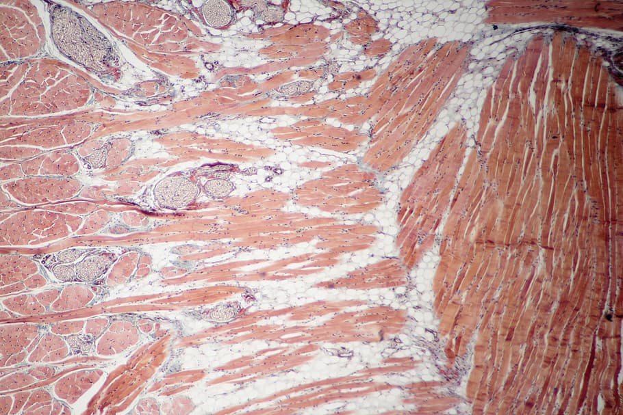 fixed, slide, cross, section, muscle tissue, 100x, 100 x microscope view, muscle, skeletal, biopsy