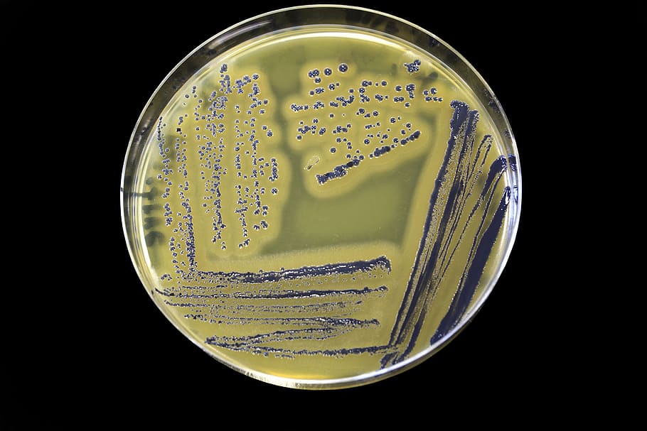 food, safety, bacteria, pathogenstaphylococcus, aureus, growing, baird, parker, agar, egg