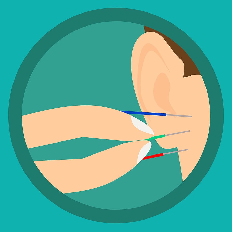 ilustrasi, jarum akupunktur, telinga., akupunktur, telinga, jarum, perawatan, ahli akupunktur, medis, alternatif