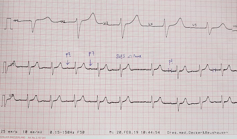 ecg, chart, investigation, heart, note, doctor's office, full frame, communication, pulse trace, backgrounds