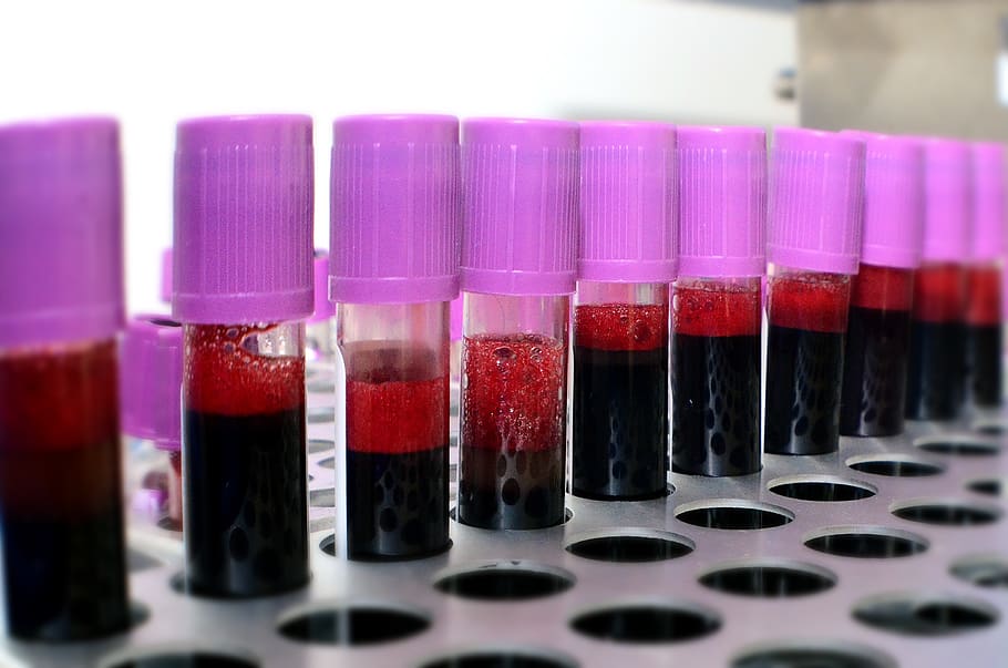 blood, donation, campaign, charity, test tube, indoors, in a row, science, scientific experiment, healthcare and medicine