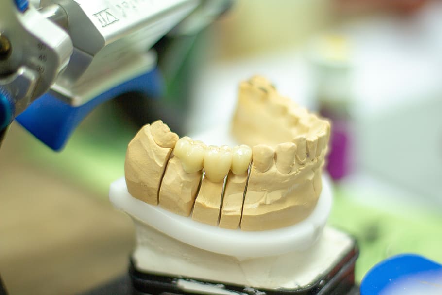 tooth replacement, dentist, healthcare, dentistry, smile, ceramic, applying, hand labor, person, clinic