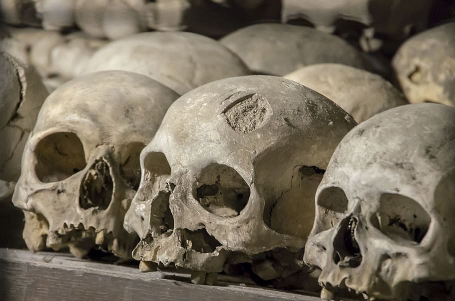 skull, cemetery, trauma, pain, death, human skeleton, bone, human skull, human bone, human body part