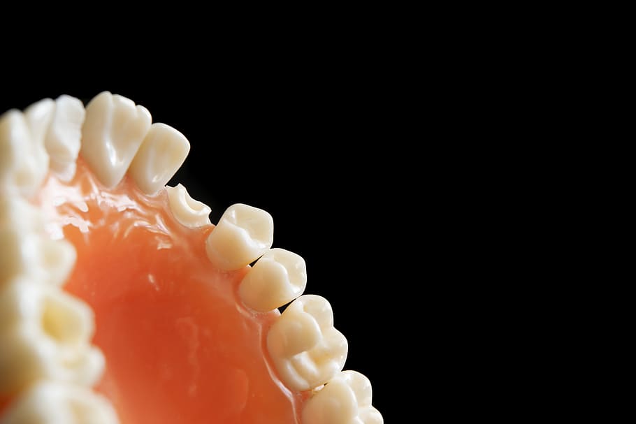 dentist, dentistry, orthodontics, decay, tooth, studio shot, black background, indoors, copy space, close-up