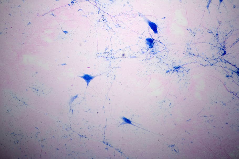 visão do microscópio, neurônio multipolar gigante, multipolar, neurônio, axônio, dendritos, central, nervoso, sistema, biologia
